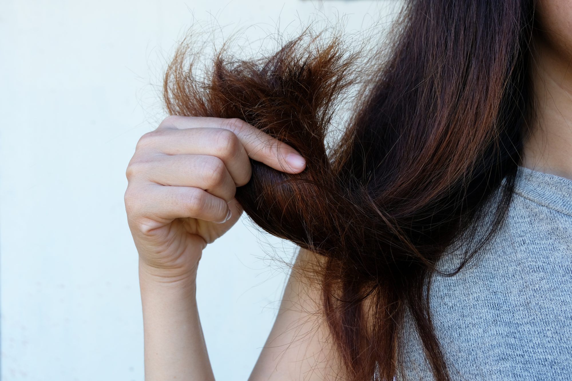 Common Hair Problems Various Reasons  Prevention  cultfit