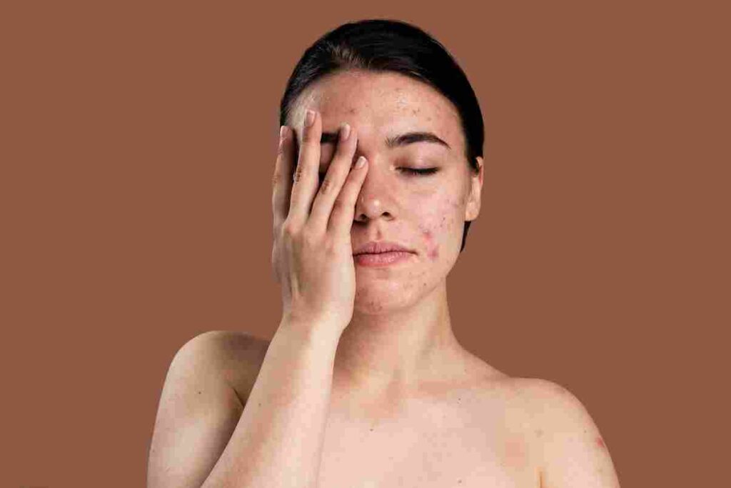 Skin Diseases Treatment In Dharwad