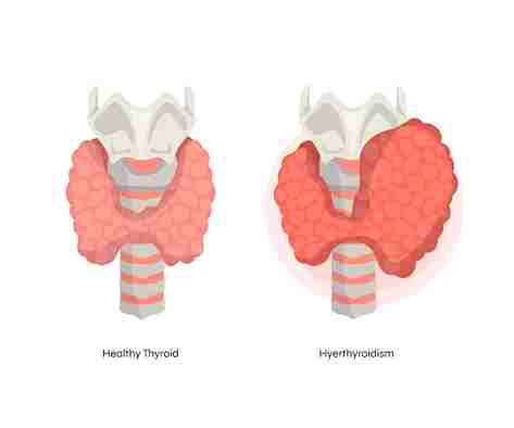 hand drawn flat design thyroid illustration 23 2149282263 11zon