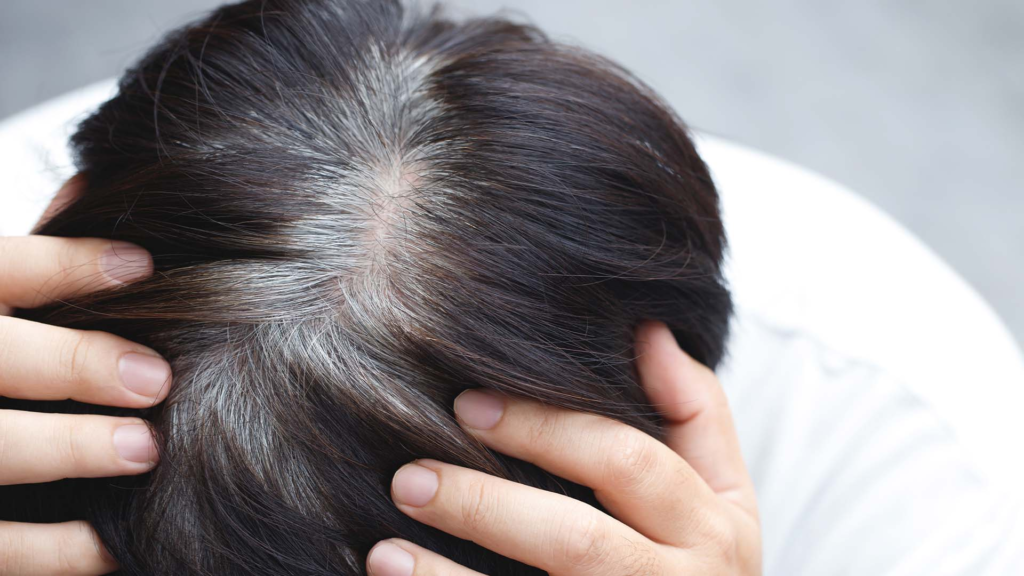 premature grey hair treatment in Dharwad