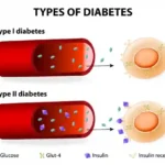 difference type 1 and type 2 diabetes 11zon 1