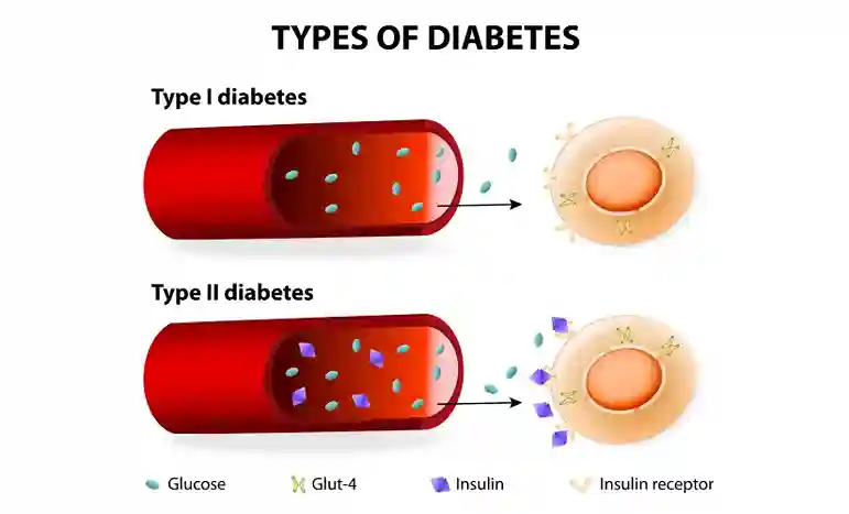 difference type 1 and type 2 diabetes 11zon 1