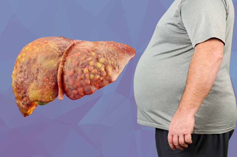 Fatty Liver Disease Treatment in Dharwad