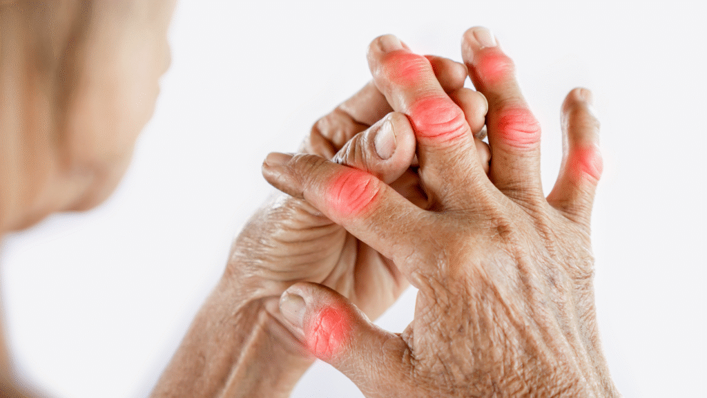 Arthritis Management in Dharwad