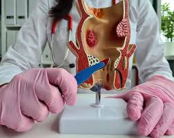 piles & fissure treatment in Dharwad
