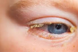 eye problems treatment in Dharwad 
