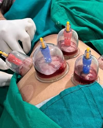 Panchakarma therapy in Dharwad 